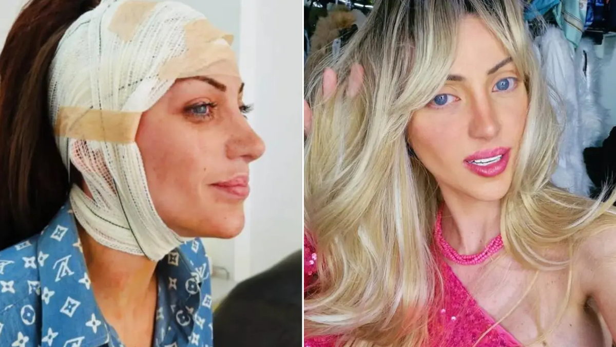 barbie bebege benzemek icin 27 kez ameliyat oldu brezilyali fenomen 31 yasinda hayatini kaybetti glv92fXT.jpg